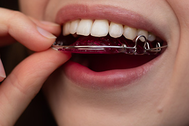 The image shows a person with an open mouth displaying a large amount of purple dental floss held between their teeth, with a visible toothbrush in their mouth.