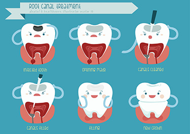 The image displays a cartoon illustration of various dental procedures with labels indicating the names of each treatment.